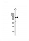 (Mouse) Gnl3 Antibody (C-term)
